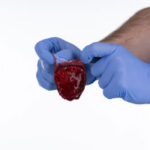 ActiGraft