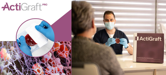 ActiGraft - Medicaltek